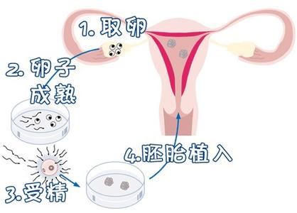 实验室3